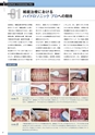 Dental Products News ハイドロソニック特集号 Vol.5